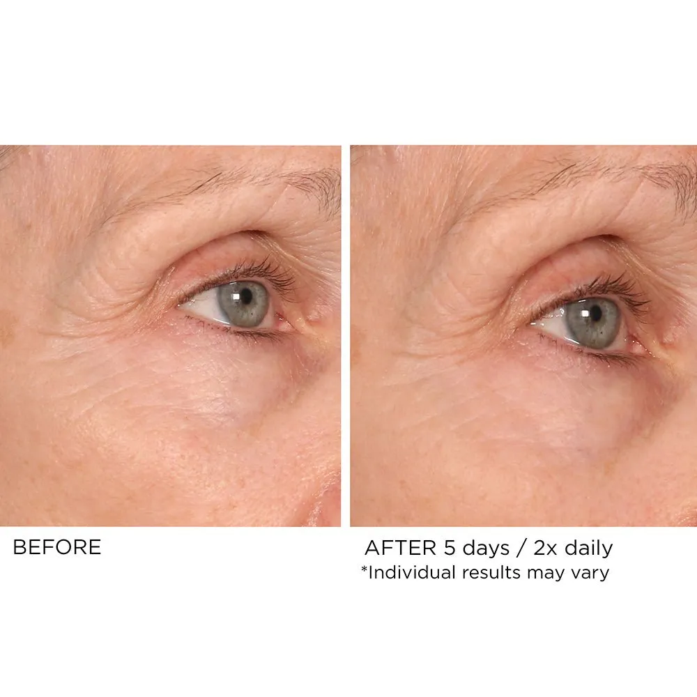 Age Defying Eye Renewal Serum