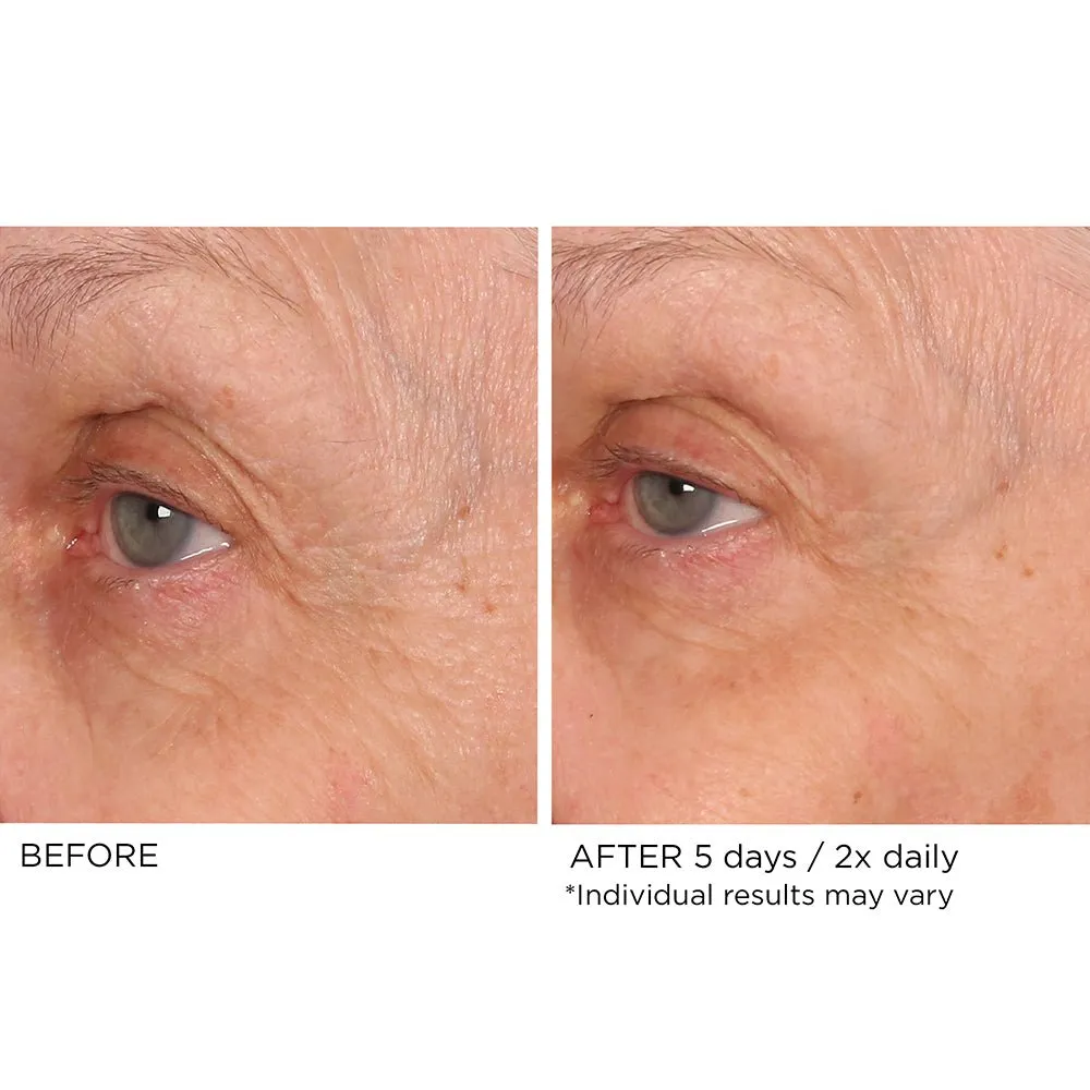 Age Defying Eye Renewal Serum